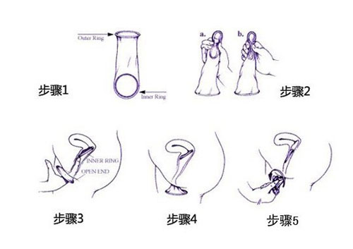 高清套圖：各色女性避孕套使用方法