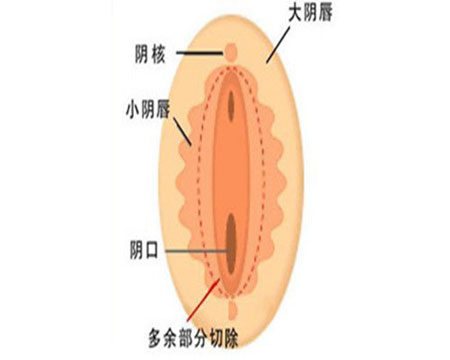 科普:女性私處自凈全過程(套圖)