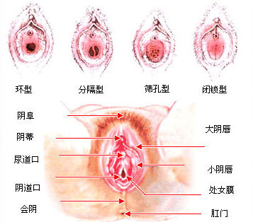 科普圖解:處女膜在陰道什麼位置