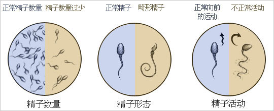 圖解:精子射入陰道進入子宮全經歷