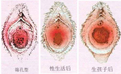 內有瞎眼圖:一起來看真人處女膜